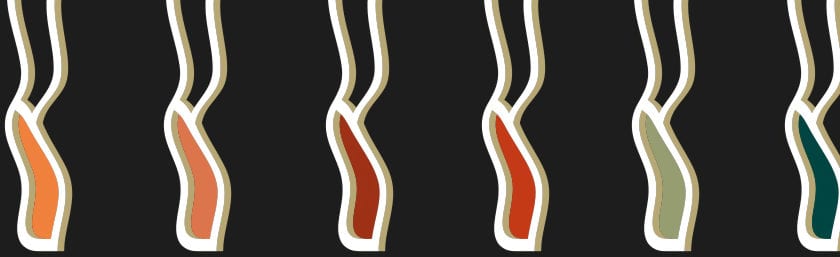 5-motifs